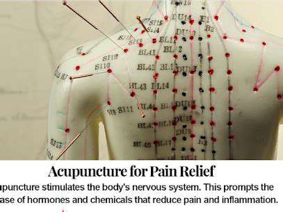 AcupunctureandtheNervousSystem:AConnectiontoSleep