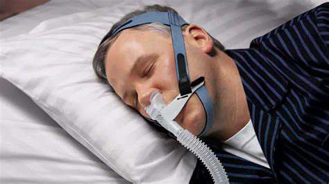 CPAPTherapy:AComprehensiveApproachtoSnoringSolutions