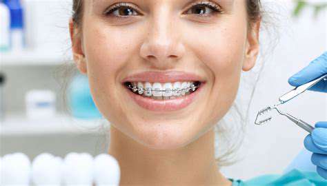 OralAppliances:ADiscreetOption