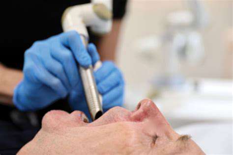 TypesofLaserTreatmentsforSnoring