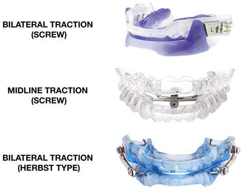 TypesofMandibularAdvancementDevices