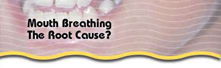 IdentifyingtheRootCauseofMouthBreathing